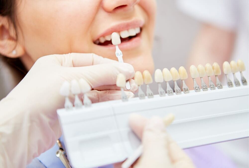 Colore denti
