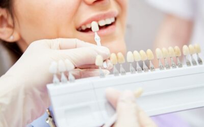 Colore denti